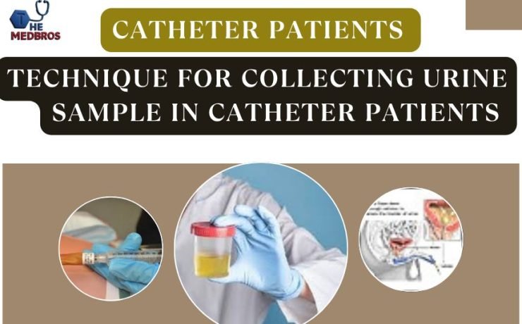 Correct technique for collecting Urine sample in Catheter Patients